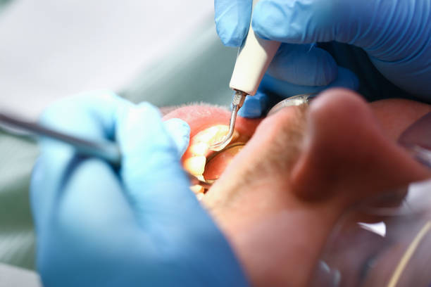 Best Emergency Wisdom Teeth Removal in Vails Gate, NY