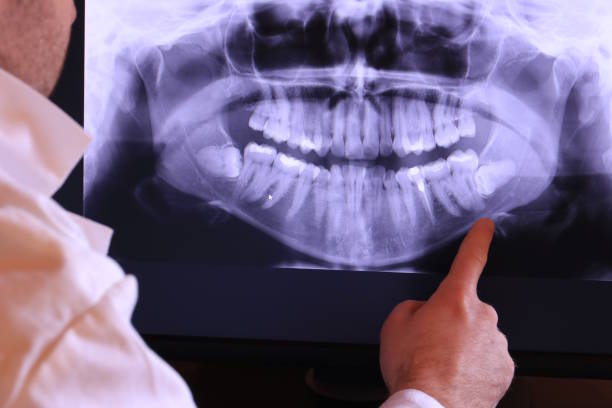 Best Emergency Treatment for Toothache in Vails Gate, NY