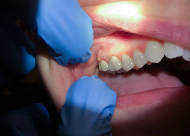 Best Weekend Emergency Dentist in Vails Gate, NY