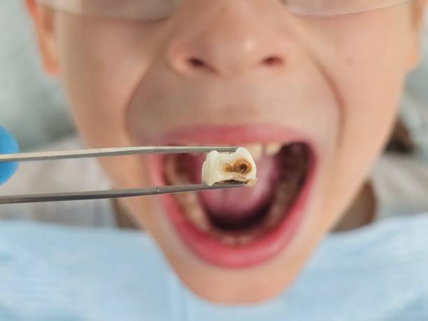 Best Emergency Treatment for Toothache in Vails Gate, NY